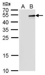 IL-28B Monoclonal Antibody (GT2512)