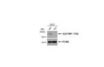 SQSTM1 Antibody in Western Blot (WB)