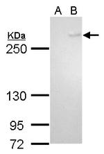 TET1 Antibody in Western Blot (WB)