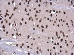 Phospho-Histone H3 (Ser10) Antibody in Immunohistochemistry (Paraffin) (IHC (P))