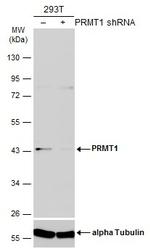 PRMT1 Antibody in Western Blot (WB)