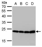 SOD2 Monoclonal Antibody (GT582)