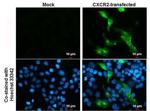 CXCR2 Monoclonal Antibody (GT547)