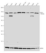 STAG1 Antibody in Western Blot (WB)