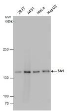 STAG1 Antibody in Western Blot (WB)