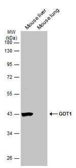 GOT1 Monoclonal Antibody (GT638)