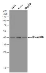 RNaseH2B Monoclonal Antibody (GT479)