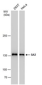 STAG2 Antibody in Western Blot (WB)