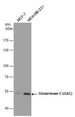 Glutaminase C (GAC) Antibody in Western Blot (WB)