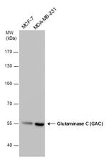 Glutaminase C (GAC) Antibody in Western Blot (WB)