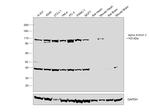 alpha Actinin 2 Antibody in Western Blot (WB)