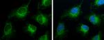 ACSL4 Monoclonal Antibody (GT186)
