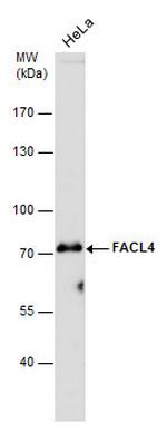 ACSL4 Antibody in Western Blot (WB)