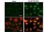 H2AK5ac Monoclonal Antibody (GT1262)