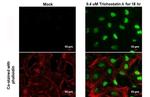 H2BK20ac Monoclonal Antibody (GT578)