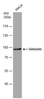 Gelsolin Monoclonal Antibody (GT667)