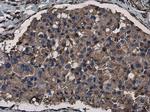 Phospho-Vimentin (Ser56) Antibody in Immunohistochemistry (Paraffin) (IHC (P))