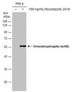 Phospho-Vimentin (Ser56) Antibody in Western Blot (WB)