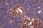 PYK2 Monoclonal Antibody (GT858)