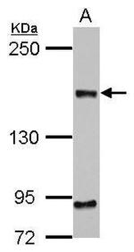 CEP164 Monoclonal Antibody (17)
