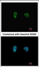 CHK2 Monoclonal Antibody (8F12)