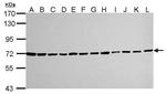 Ku70 Antibody in Western Blot (WB)