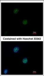 ATM Antibody in Immunocytochemistry (ICC/IF)
