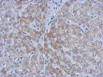 ATM Antibody in Immunohistochemistry (Paraffin) (IHC (P))
