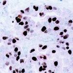 CENPF Antibody in Immunohistochemistry (IHC)