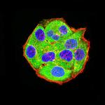 ADAR Monoclonal Antibody (4E2E4)