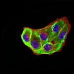 ADORA2A Antibody in Immunocytochemistry (ICC/IF)