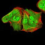 ALDH6A1 Monoclonal Antibody (6H9B7)