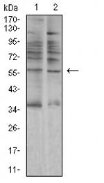 alpha Amylase 1 Monoclonal Antibody (5G6F7)
