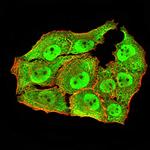 APC10 Monoclonal Antibody (8F1D10)