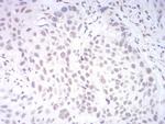 KDM1B Antibody in Immunohistochemistry (Paraffin) (IHC (P))