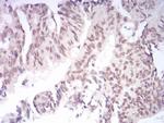 KDM1B Antibody in Immunohistochemistry (Paraffin) (IHC (P))