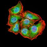 ATG2A Monoclonal Antibody (4E6D4)