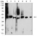 AUP1 Monoclonal Antibody (1H6A1)