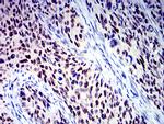 BCL9L Monoclonal Antibody (3B9C1)