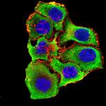 CHRNA3 Monoclonal Antibody (6D3A10)