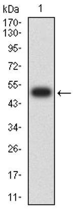 CHRNB3 Antibody in Western Blot (WB)