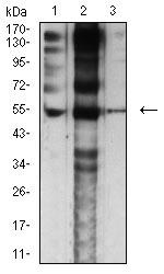 CHRNE Monoclonal Antibody (4E10F6)