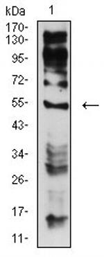 CHRNE Antibody in Western Blot (WB)
