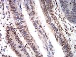 CIRBP Antibody in Immunohistochemistry (Paraffin) (IHC (P))