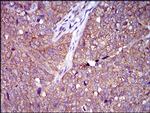 CLGN Antibody in Immunohistochemistry (Paraffin) (IHC (P))