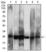 CK2 beta Monoclonal Antibody (1H8A5)