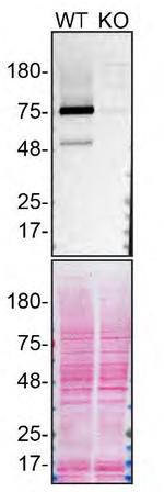 DDX1 Antibody