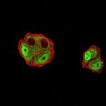 DDX1 Monoclonal Antibody (3E5B2)
