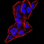 Gemin 3 Monoclonal Antibody (7B2B1)