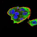 Gemin 3 Monoclonal Antibody (1C9F6)